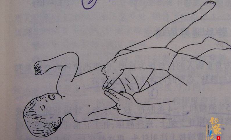 婴幼儿平卧，抢救者在其足侧施救