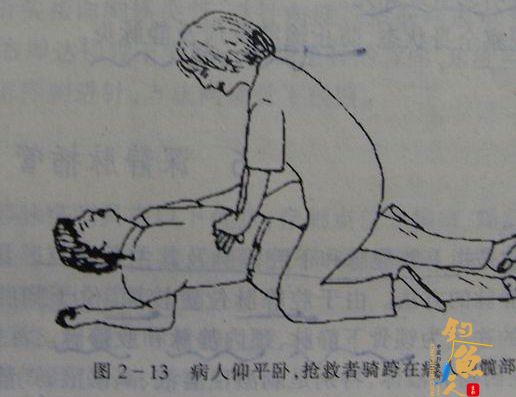 病人仰平卧，抢救者骑跨在病人的髋部