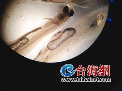 厦门市民买到疑似人造银鱼 吃着像QQ糖放两天不烂  图